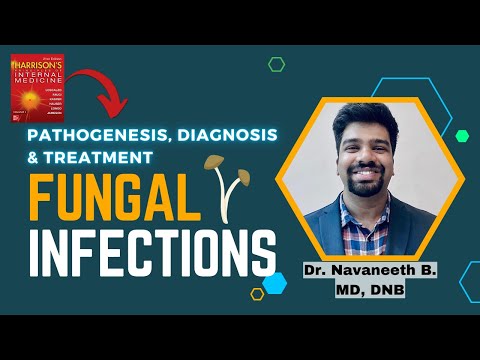 FUNGAL INFECTIONS | Pathogenesis | Diagnosis | Treatment | Harrison