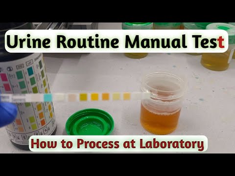 Urine routine test