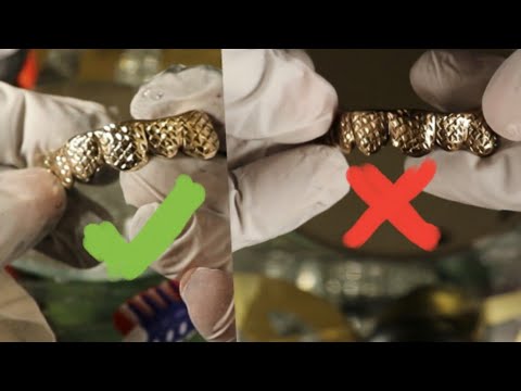 How to clean your gold grillz teeth totally dirty