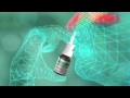 Sinutab Big Head TVC HD
