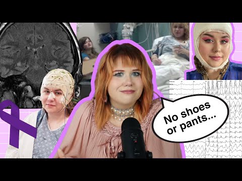 I had a seizure (my journey with epilepsy)