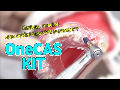 [EASY Hands-on] OneCAS KIT - #25, #26 Missing Case