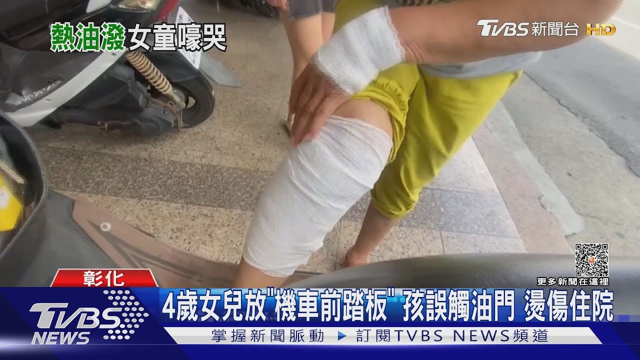 4歲女兒放「機車前踏板」孩誤觸油門　燙傷住院