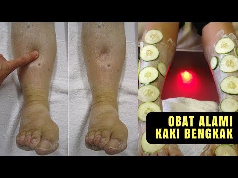 Tipis 66 kg Minyak Siberia untuk menurunkan berat badan
