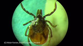 preview picture of video 'Nature Miracle: Dogs Tick Ixodes ricinus in Kiev, Ukraine X 200 Under Microscope'