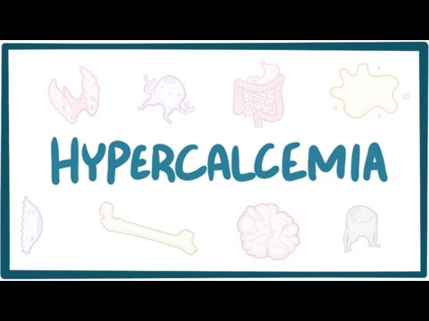 Hypercalcemia - causes, symptoms, diagnosis, treatment, pathology