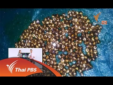 โรคสะเก็ดเงินที่นิ้วมีเล็บรูปภาพ คนที่ได้รับรางวัลโรคสะเก็ดเงิน