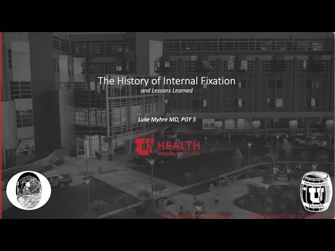 The History of Internal Fixation: and Lessons Learned