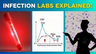 “Infection Labs Explained: Procalcitonin, CRP vs ESR, and WBC Differential for Nurses”