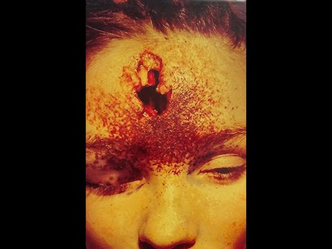 HARDCORE - Paul Elstak vs. Distortion - What's Wrong with my Brain - [Remastered HQ]