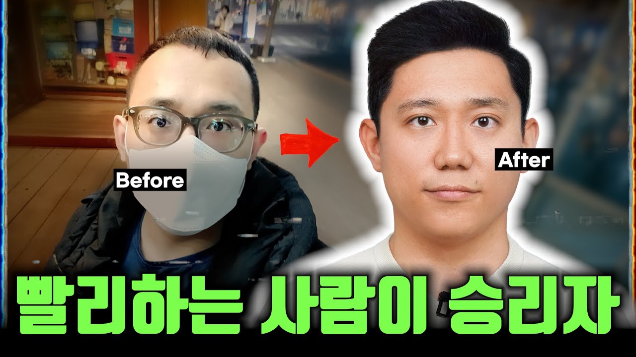 더 이상 고민하지 마세요! 모발이식 1년 후기 | 탈탈극장