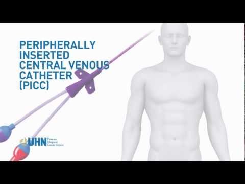 Learn About the Peripherally Inserted Central Venous Catheter (PICC)