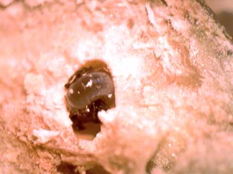Come guarire parassiti a bambini Quali farmaci per vermi a 2 anni x