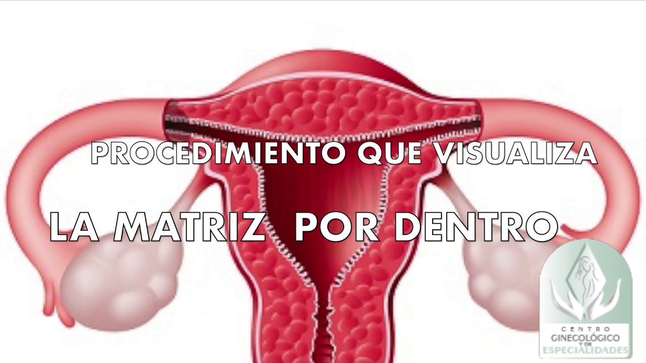 Ramón Bejarano Blanes-14