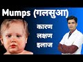 Mumps Symptoms Treatment | Galsua ka ilaj | Mumps