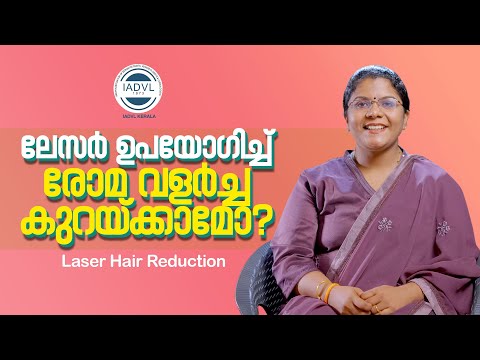 അമിതരോമവളർച്ചയ്ക്കു പരിഹാരം: Laser Hair Reduction