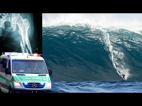 Massive Swell Hits West Oz - Gold Coast Surfer Has Leg Crushed By Huge Wave