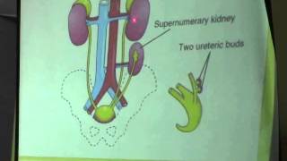 12) Dr.Doaa 20/4/2015 [metanephros - conginetal anomalies of kidney - cloaca - urinary bladder]