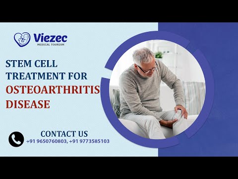 Stem Cell Transplant for Osteoarthritis Guide