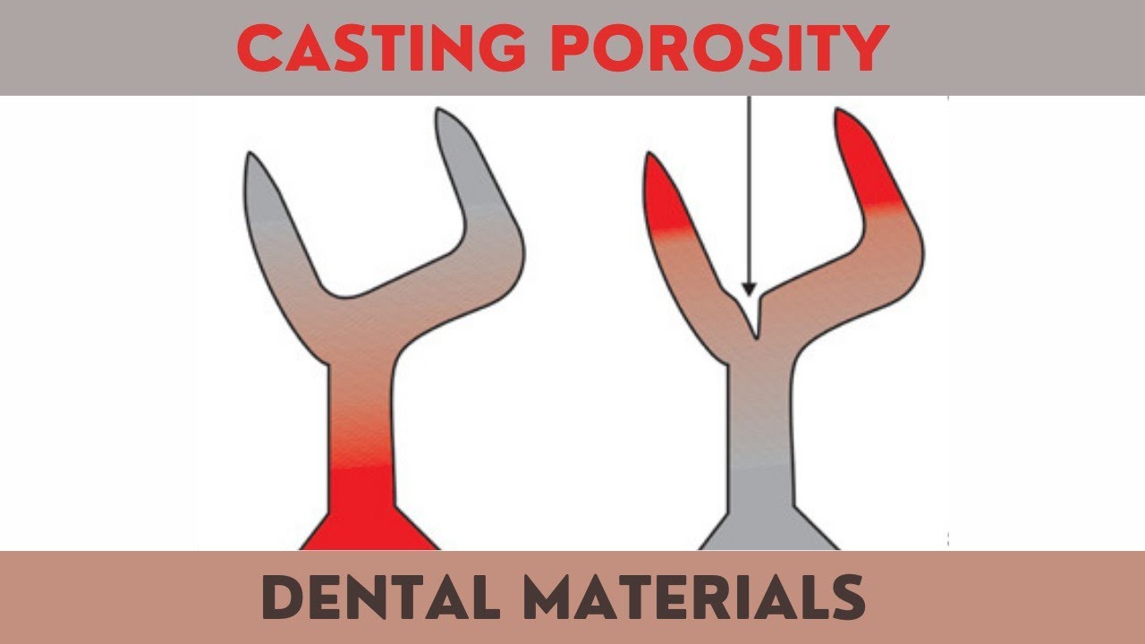 Types of Casting Porosity | Suck Back | Pinhole | Casting Defects