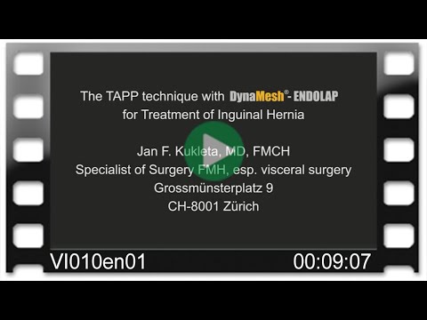 DynaMesh®-ENDOLAP - OR-Video: TAPP technique for Treatment of Inguinal Hernia
