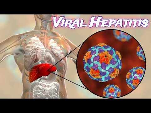 Viral Hepatitis - CRASH! Medical Review Series