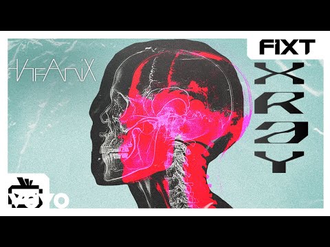 Video thumbnail for XRAY