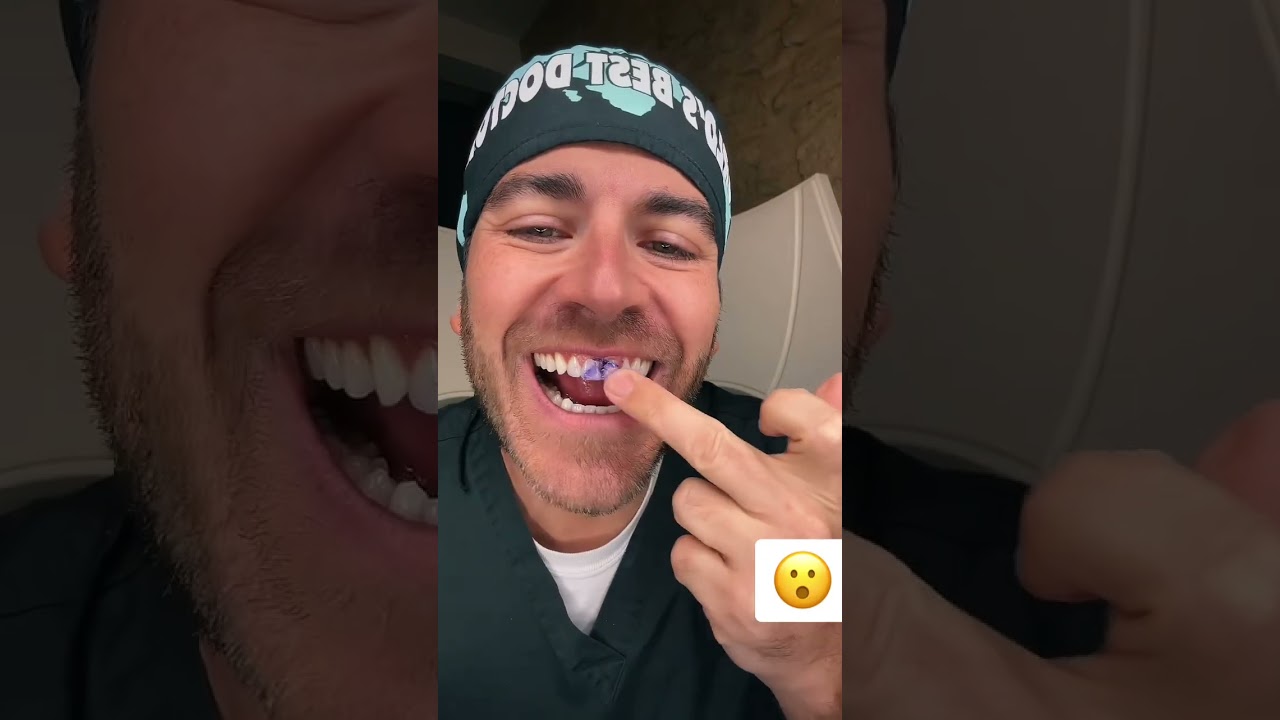 Ce dentifirce violet blanchit vraiment les dents  #shorts