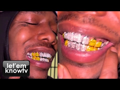 Sauce Walka Checks Out His Artist Sauce Gohan's New Diamond Grillz From Johnny Dang | Pure Jewelry