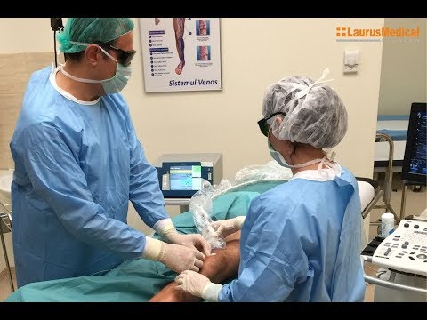 chirurgie laser varicoza pe picioare pre