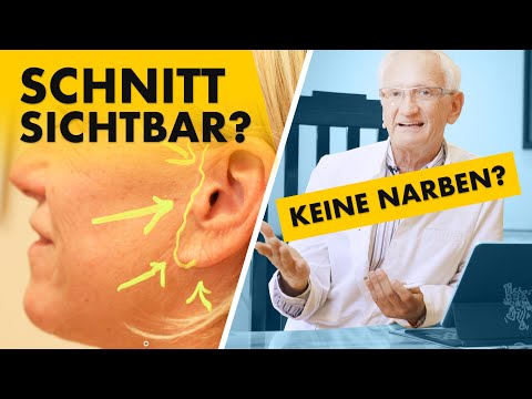 Ein Facelift ohne Narben geht nicht! | Dr. Jungwirth