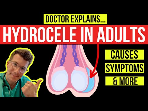 What is a HYDROCELE? Doctor explains causes, symptoms and treatment (including surgery)