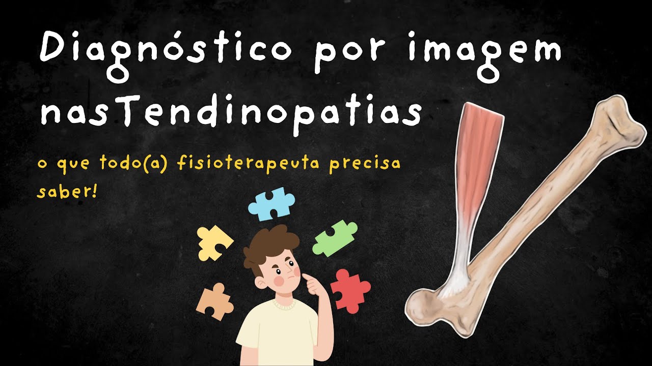 Diagnóstico por Imagem nas Tendinopatias: o que todo(a) fisioterapeuta precisa saber