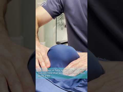 What is a Tissue Expander?