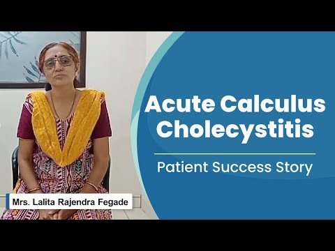 Acute Calculus Cholecystitis Treatment Success Story | Medicover Nashik - Video Thumbnail