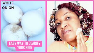 EASY AND NATURAL WAY TO CLARIFY FACE / SKIN WITH ONLY WHITE ONION JUICE