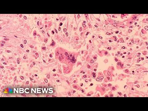 Doctors in Pennsylvania estimate at least six babies have been born with measles