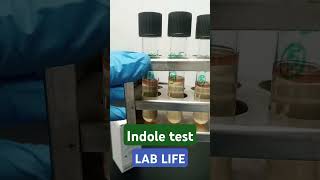Download lagu E, coli # Escherichia coli testing#indole test#Food test mp3 Download lagu E, coli # Escherichia coli testing#indole test#Food test mp3