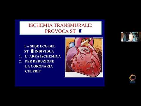 P. Delise - Elettrocardiografia 2.0.