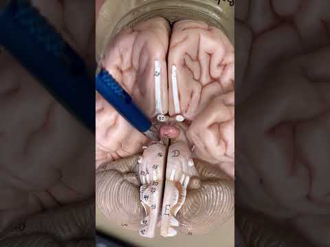 How to identify the cranial nerves part1! #clinicalanatomy #medical #medstudent