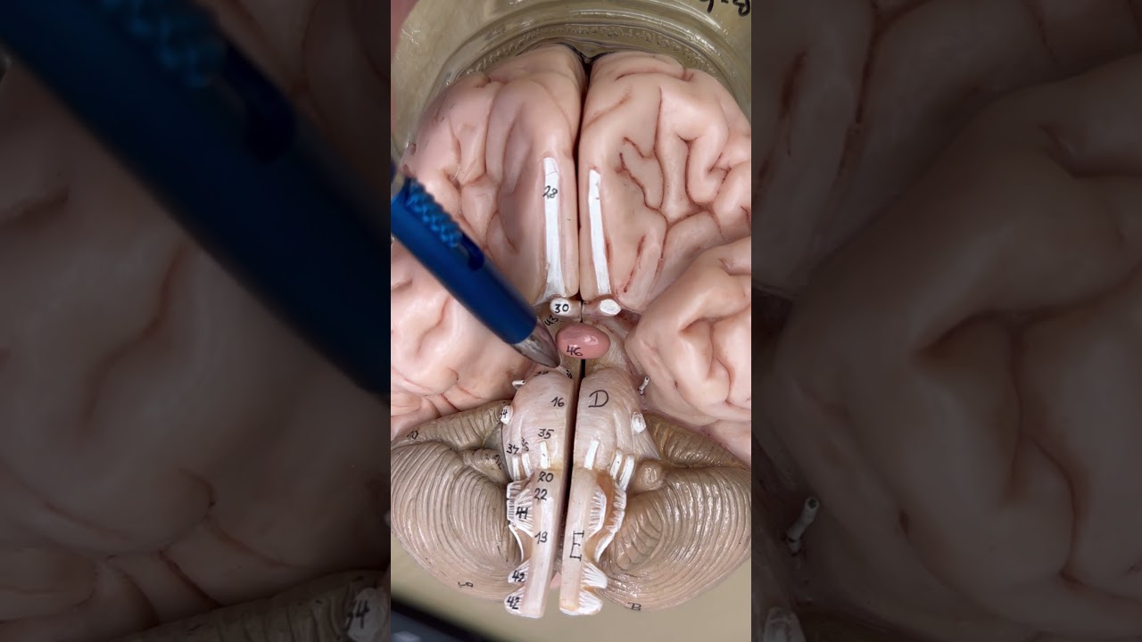 How to identify the cranial nerves part1! #clinicalanatomy #medical #medstudent