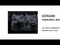 Urolithiasis – Pathogenesis, Presentation, and Management
