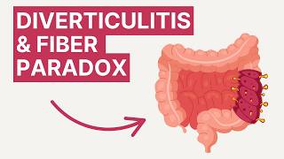 Diverticulitis and Fiber: How to Heal After a Flare-Up