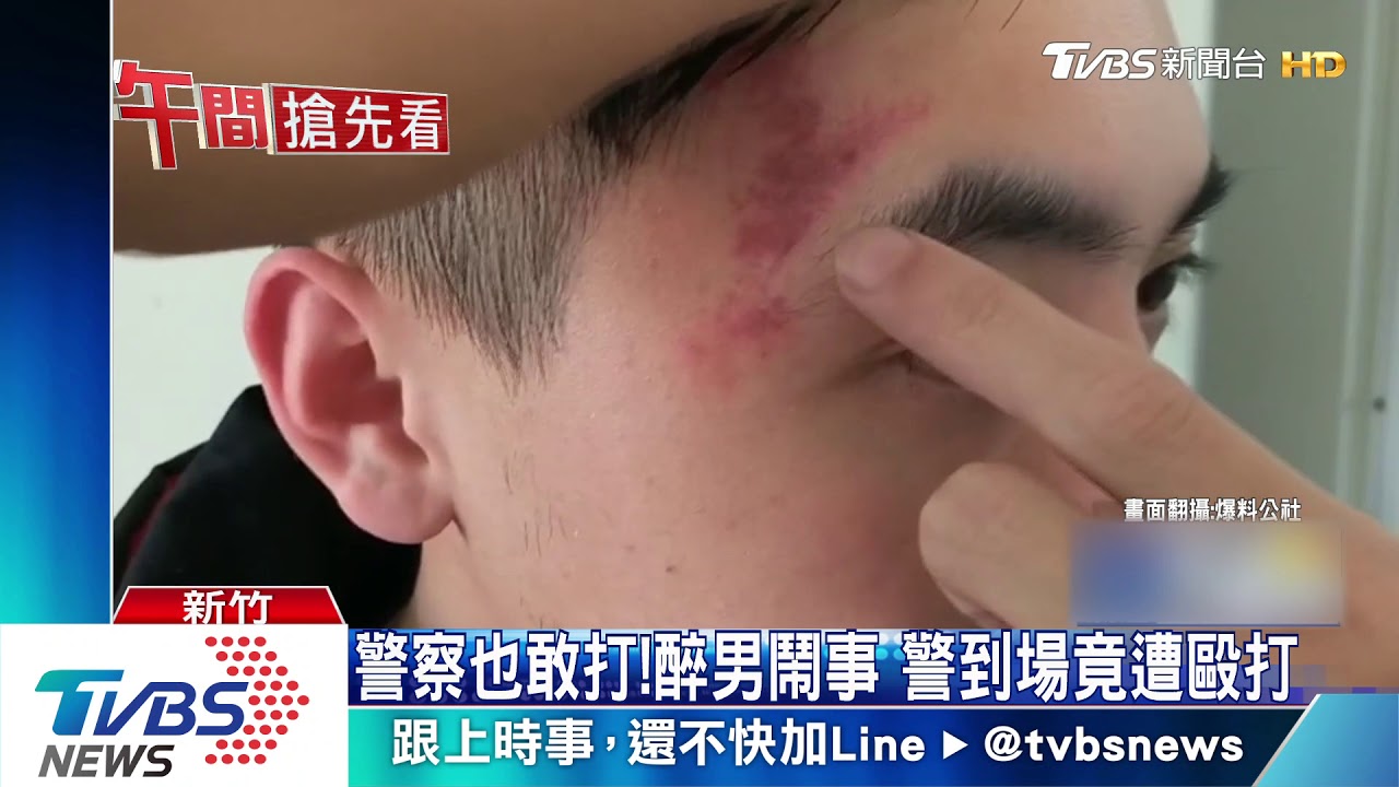 警察也敢打!醉男鬧事 警到場竟遭毆打