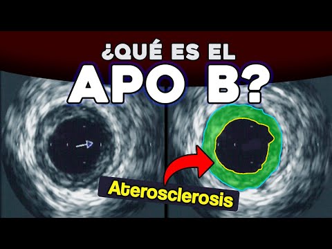 La Causa REAL de la Aterosclerosis | La Ciencia del Colesterol Pt 2