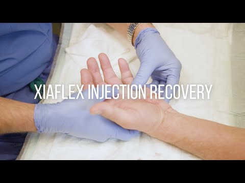 Dupuytren's Contracture Injection Recovery Instructions