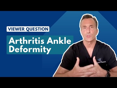 Big Toe Joint Replacement vs Joint Cleanup Ask Dr Moore