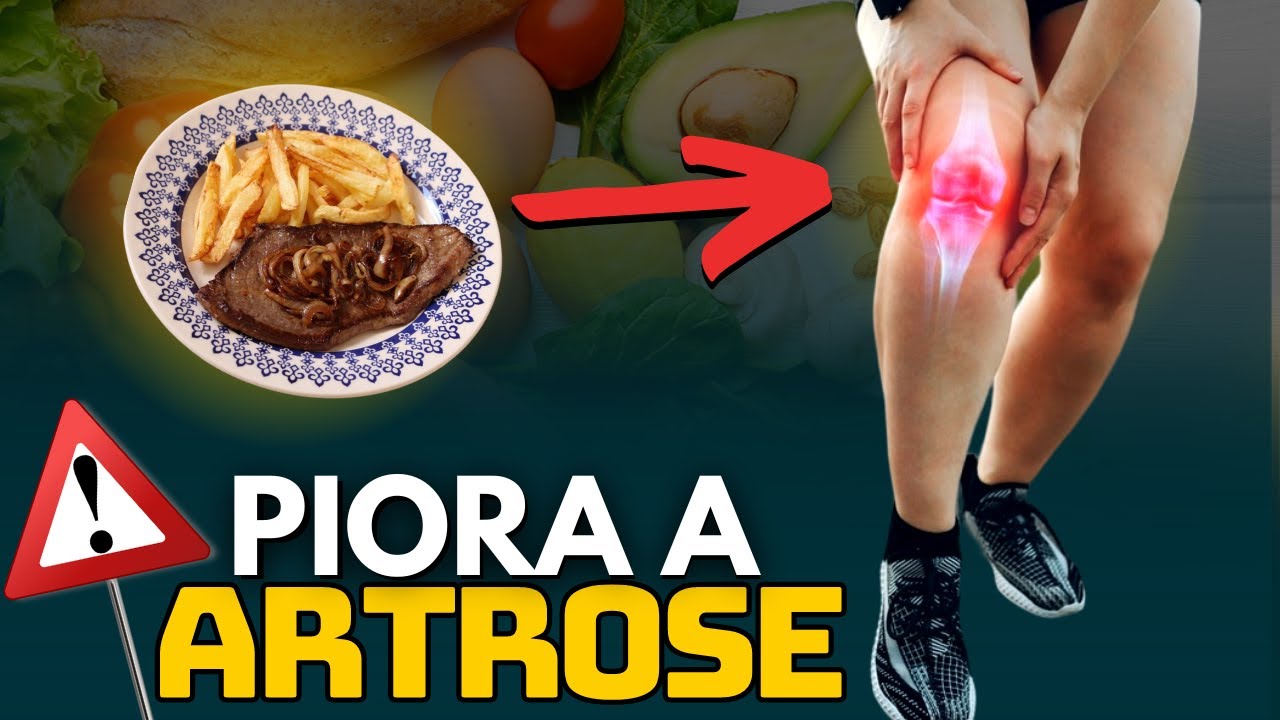 A verdade sobre alimentos que PIORAM A ARTROSE