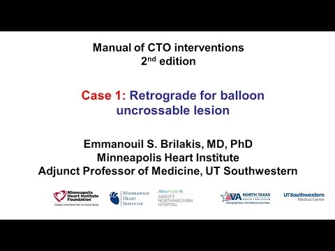 Case 1: Manual of CTO Interventions - Retrograde for balloon uncrossable lesion