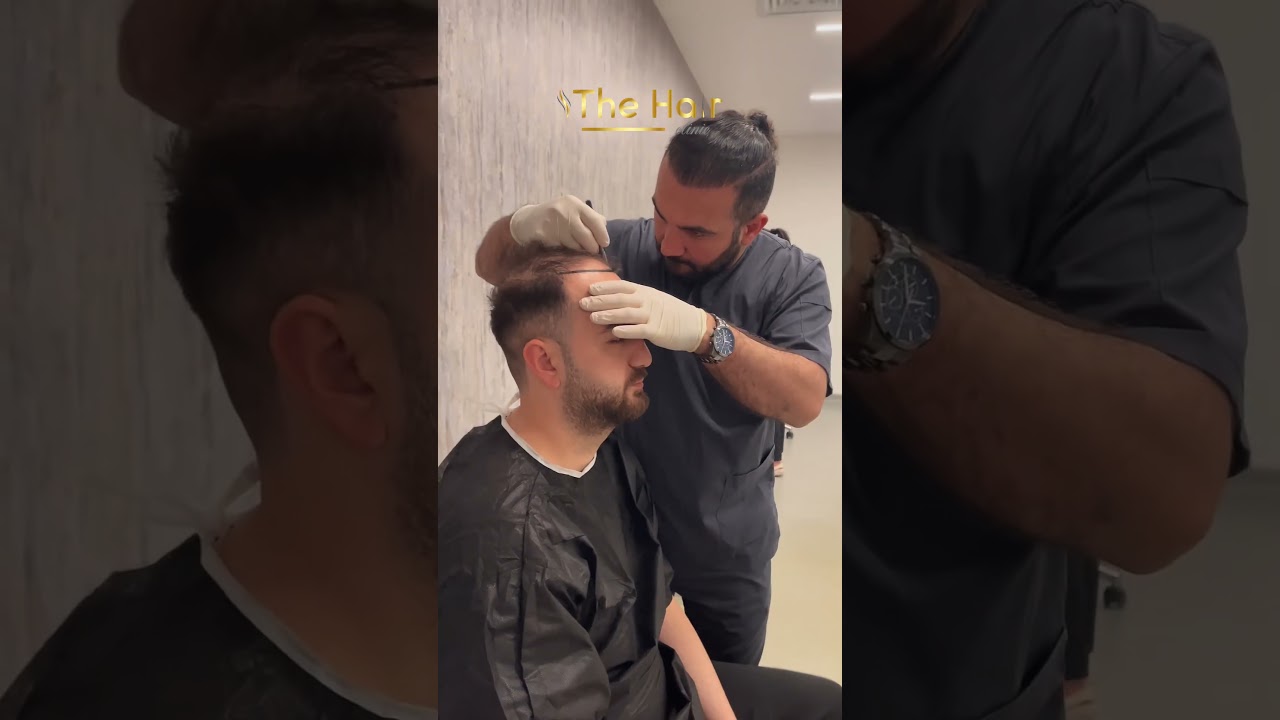 Saç Ekimi Teknikleri